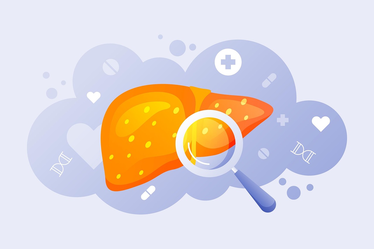Hepatic Cyst Liver: Causes, Symptoms, Diagnosis, and Treatment Options (Complete Guide)